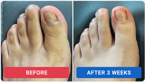 Orville Anti Fungus Reviews